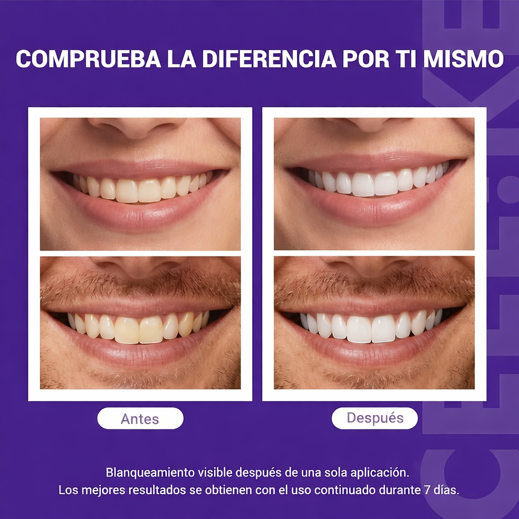 Tiras blanqueadoras de dientes™