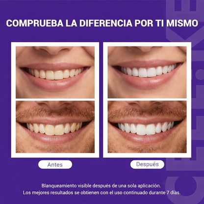 Tiras blanqueadoras de dientes™